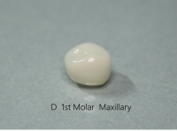 D 1ST MOLAR/ E 2ND MOLAR  STANDARD FIT 3ea 묶음