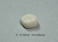 D 1ST MOLAR/ E 2ND MOLAR  STANDARD FIT 3ea 묶음