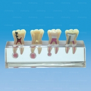 P23-END.4