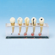P23-END.2