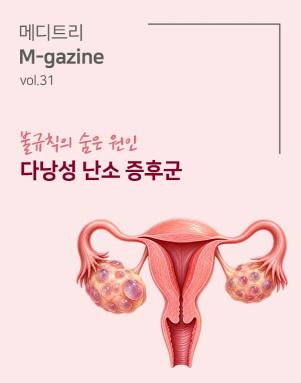 썸넬_다낭성난소증후군.jpg