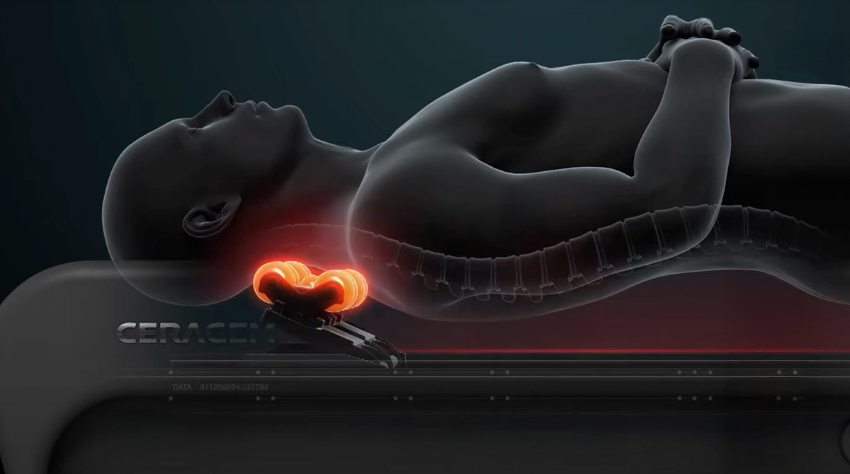 [구독] 의료기기 마스터 THE NEW V4 의  CST 세라코어 엔진  상세 이미지