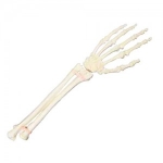 ORTHObones™ 손목 Wrist W19143