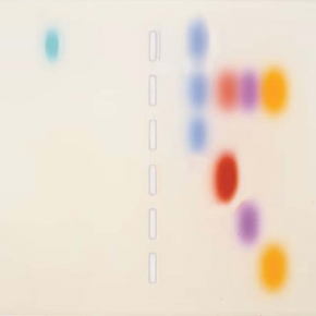 전기영동의 원리와 실험