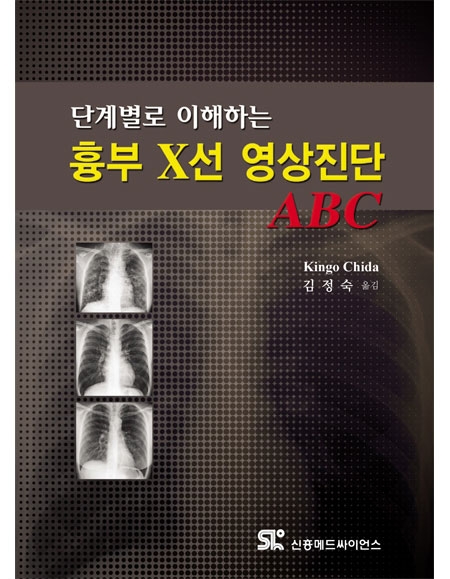 단계별로 이해하는 흉부 X선 영상진단 ABC