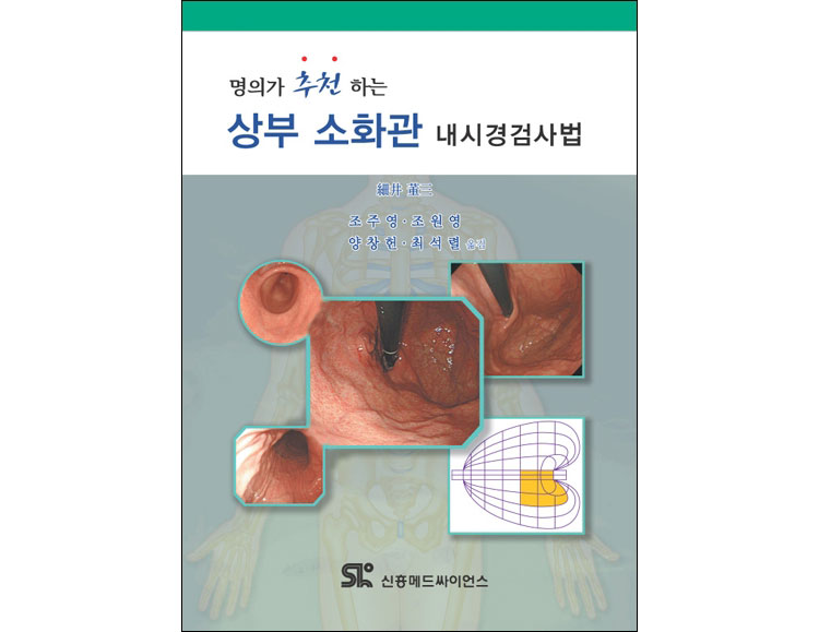 상부 소화관 내시경검사법