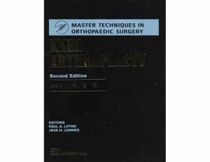 Knee Arthroplasty 한국어판 (MTOS)