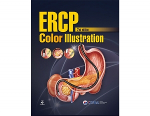 ERCP Color Illustration 2e