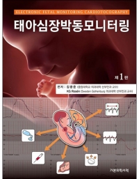 태아심장박동모니터링-1판