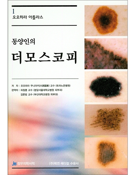 동양인의 더모스코피 _정우의학서적