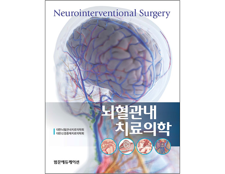 뇌혈관내 치료의학 _범문에듀케이션