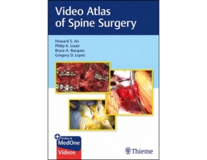 Video Atlas of Spine Surgery