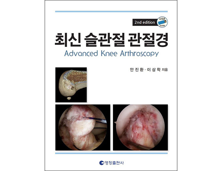 최신 슬관절 관절경 2판 _영창출판사