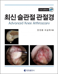 최신 슬관절 관절경 2판 _영창출판사