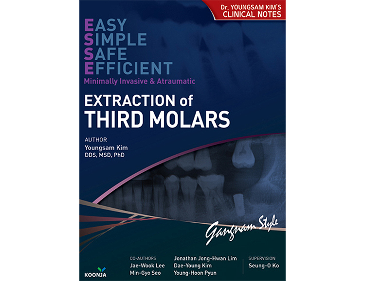 사랑니발치(영문판) Extraction of Third Molars _군자출판사