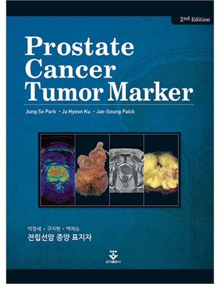 전립선암 종양 표지자 2판 _군자출판사