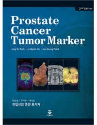전립선암 종양 표지자 2판 _군자출판사