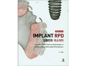 임플란트 국소의치 (Implant RPD) _군자출판사