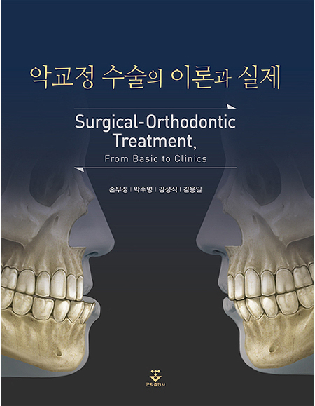 악교정 수술의 이론과 실제 _군자출판사