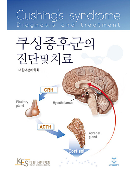 쿠싱증후군의 진단 및 치료 _군자출판사