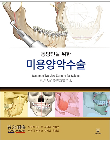 동양인을 위한 미용양악수술 _군자출판사