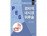 경피적 내시경 위루술 (PERCUTANEOUS ENDOSCOPIC GASTROSTOMY) _도서출판 대한의학