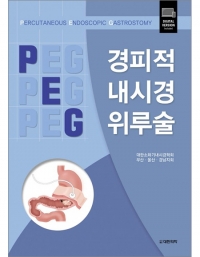 경피적 내시경 위루술 (PERCUTANEOUS ENDOSCOPIC GASTROSTOMY) _도서출판 대한의학