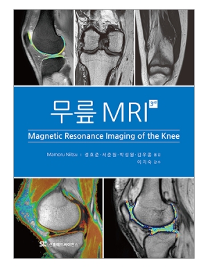 무릎 MRI _신흥메드싸이언스