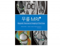 무릎 MRI _신흥메드싸이언스