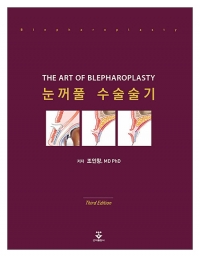눈꺼풀 수술술기 3판 _군자출판사