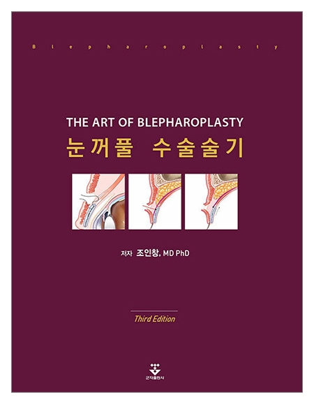 눈꺼풀 수술술기 3판 _군자출판사 눈꺼풀 수술술기 3판 _군자출판사