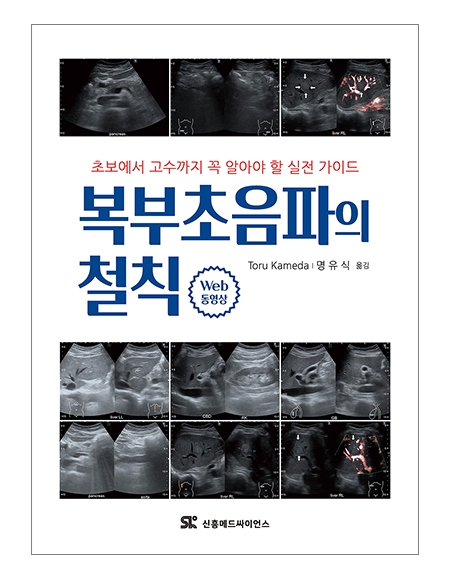 복부초음파의 철칙 _신흥메드싸이언스
