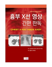 흉부 X선 영상 간편 판독(Chest X-Ray Made Easy) _메디안북