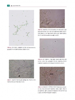 생식기 피부질환 진료지침 4판_가본의학