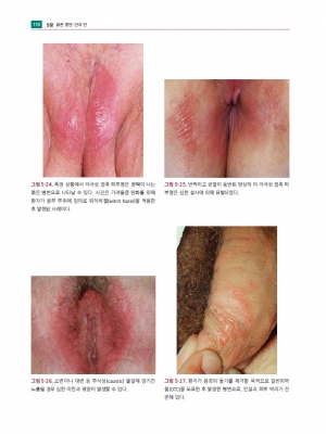 생식기 피부질환 진료지침 4판_가본의학