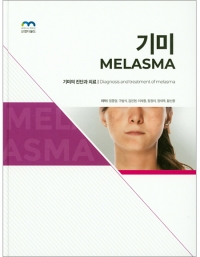 기미 (Melasma) _엠디월드