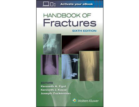 Handbook of Fractures 6e