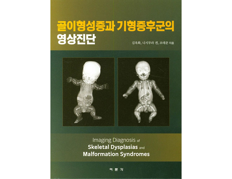 골이형성증과 기형증후군의 영상진단 _여문각