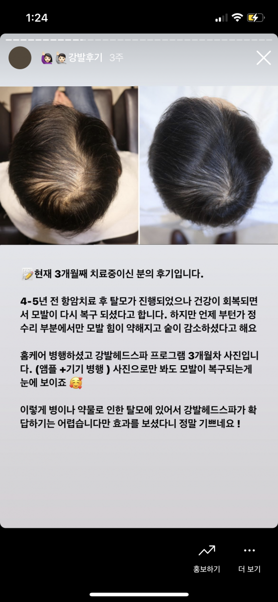 첨부이미지