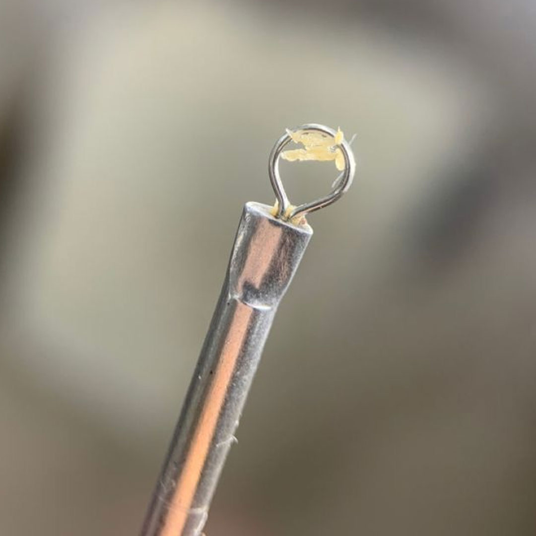 여드름 압출, 집에서 해도 될까? 안전한 관리법 알려드립니다