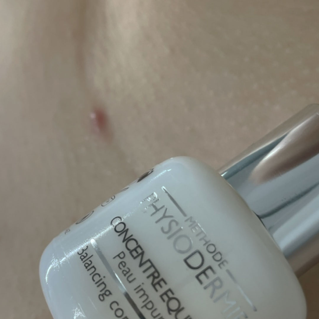 화농성여드름 치료 순서｜항생제·연고·스킨케어 활용법