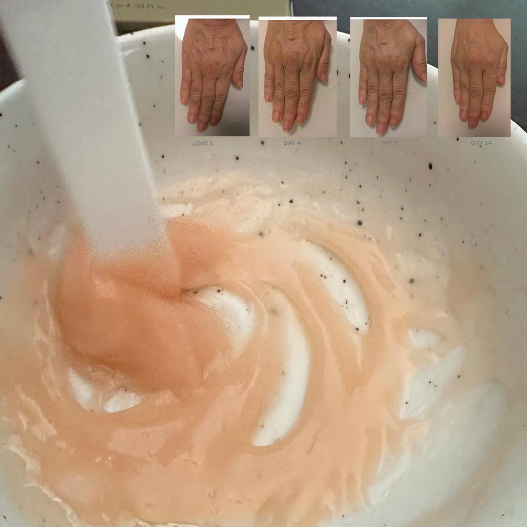 손등 주름 없애는 방법