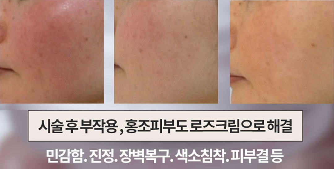b124d8cbfee557a21886fe6862584eae_133627.jpg