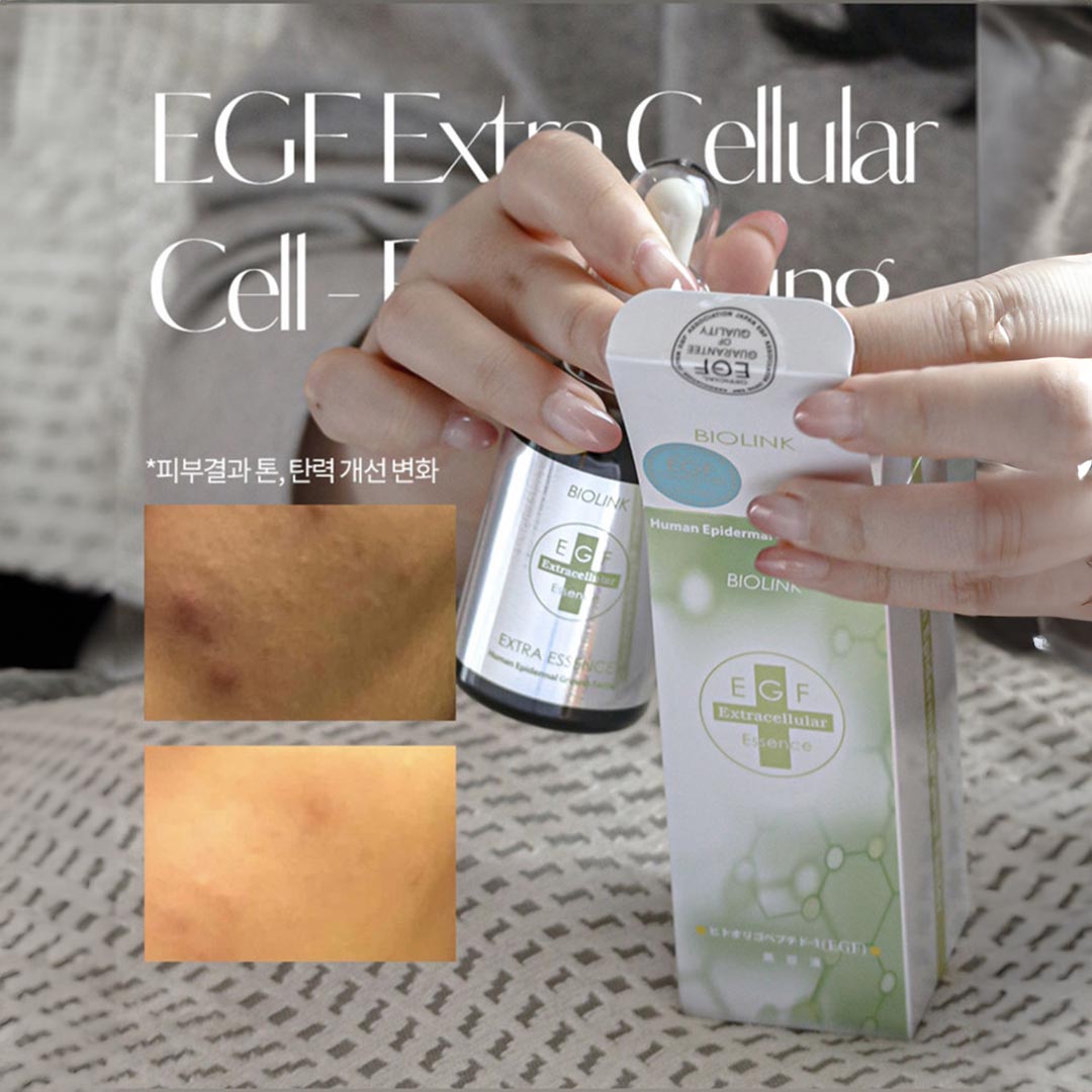EGF화장품이 시술 후 재생관리에 최고인 이유