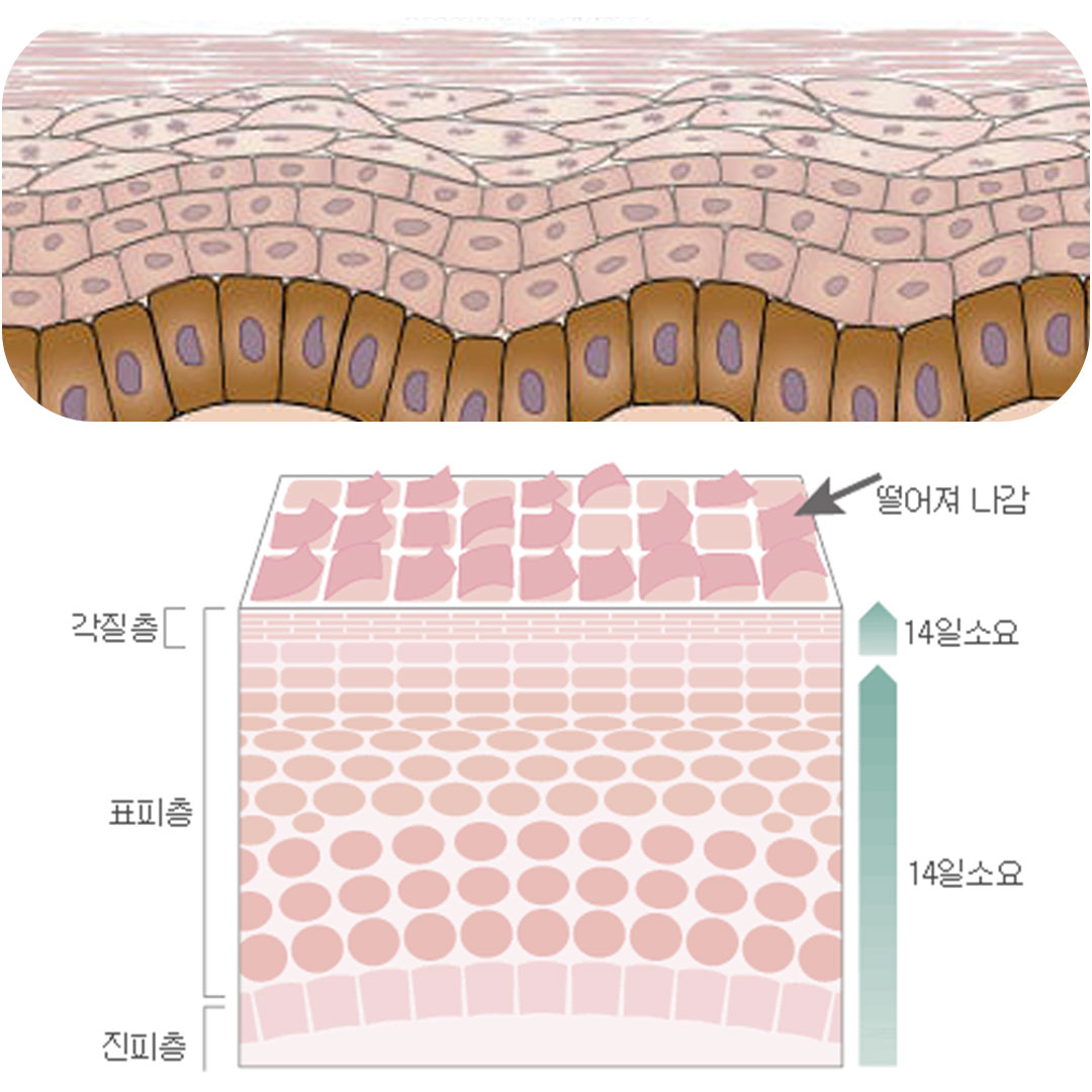 몇달이 지나도 예민한 레이저 후 피부관리