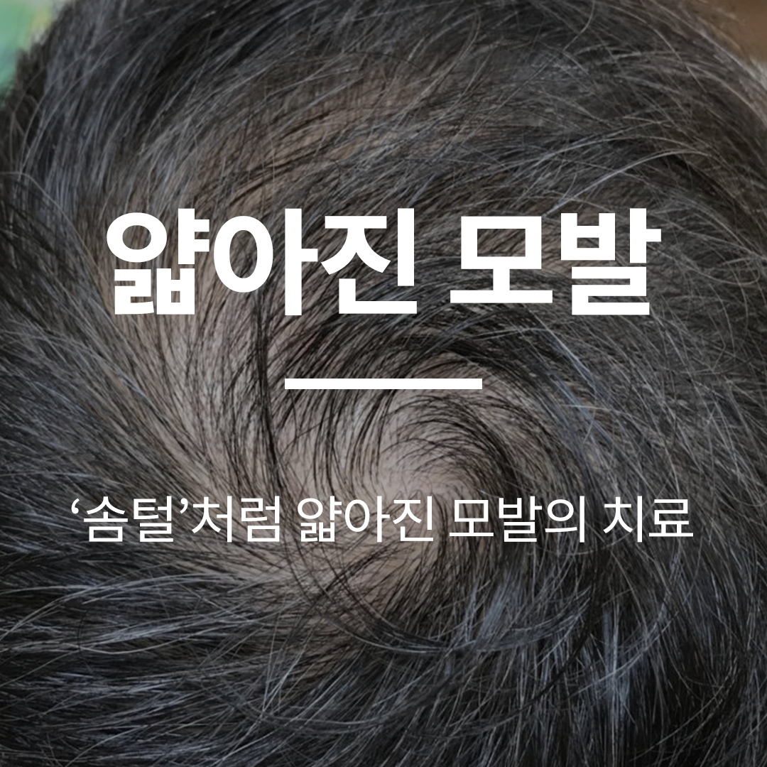 첨부이미지