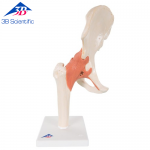 기능형 고관절 모형 Deluxe Functional Hip Joint Model A81/1 [1000162]