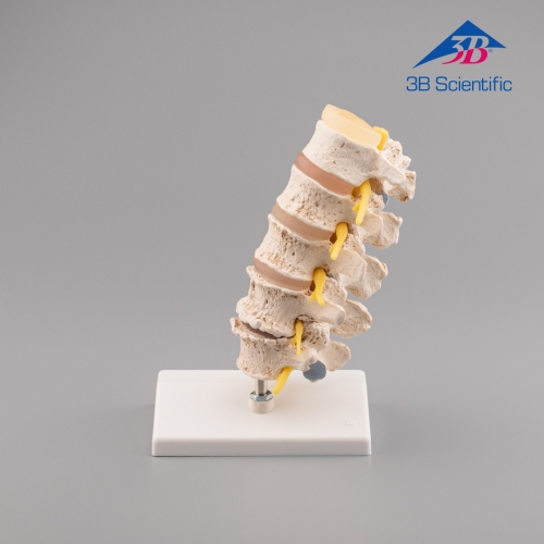 퇴행성(골다공증)척추 A795 / 추간판 탈출증의 전이단계와 퇴행성 척추증 Stages of disc prolapse and vertebral degeneration