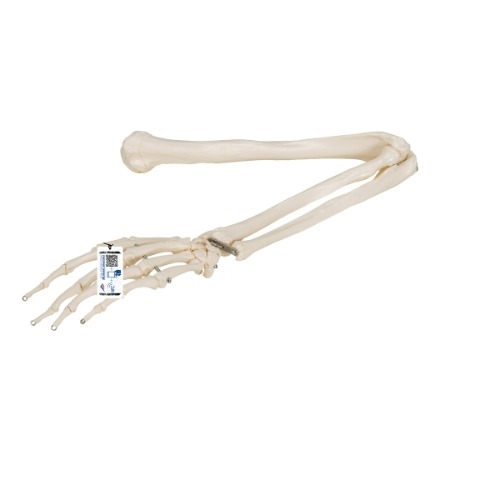 3B Scientific 팔 골격 모형 Arm Skeleton A45 [1019371]