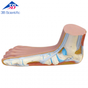 평발 Flat Foot (Pes Planus) M31 [1000355]